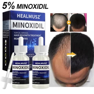 Minoxidil 5% Extra Strength Hair Regrowth Treatment Topical Solution for Men - Picture 1 of 18