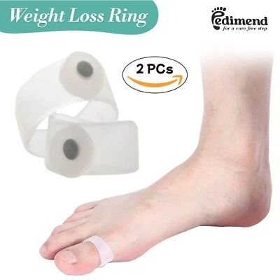 Anillo magnético de silicona para adelgazar pie Pedimend 2X pérdida de peso salud fitness Foto 1 de 4