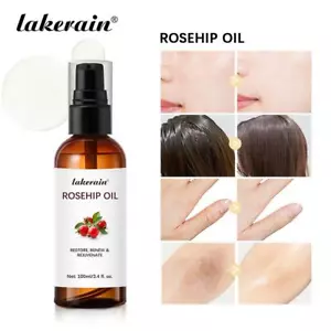 Organic Rosehip Seed Oil Rose Hips Face Oils 100ml Fast-Absorbing Skin Care ✨f - Picture 1 of 16