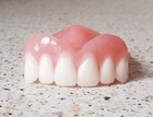 Teilweise,Zahnprothese,zahnersatz,prothese, oberkiefer, dental,Gebiss,