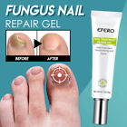 Nail Treatment Feet Care Gel Whitening Toe Nail Fungus Removal Repair Essence