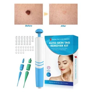 40x Rubber Bands+10x Alcohol Pad Skin Tag Remover Wart Removal Kit Painless - Picture 1 of 10