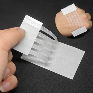 Wound Skin Closure Strips Postpartum Wound Repair Seam-Free Adhesive - Picture 1 of 16