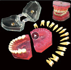 Dental Standard Typodont Model Soft Gum With 28 Removable Teeth Adult for Study