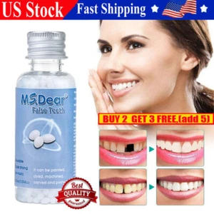 Temporary Tooth Repair Kit Temp Dental Repair Replace Missing Teeth DIY Moldable - Picture 1 of 18