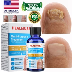 HEALMUSZ Finger Nail And Toe Nail Fungus Treatment Solution, Fungal Nail Repair - Picture 1 of 15