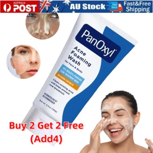 PanOxyl Benzoyl Peroxide 10% Foaming Acne Wash Skin Care - 156g - BRAND NEW - Picture 1 of 14