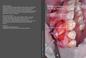 Dental surgical connective tissue graft DVD - Picture 1 of 7