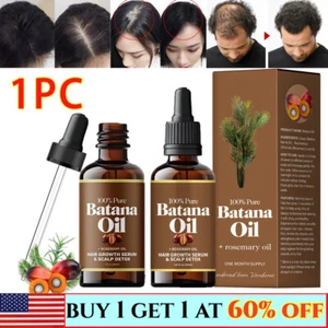 Batana Oil with Rosemary for Hair Growth - Nourish Scalp & Detox for Strong - Imagen 1 de 7