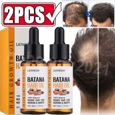 Acondicionador de aceite de batana 2 piezas - Tratamiento para el cuidado de la piel para el crecimiento del cabello - puro y natural Foto 1 de 4