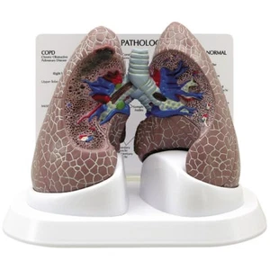 COPD Lung Cancer GPI Anat Model w Key Card LFA #3110 Make Us an Offer! SEE VIDEO - Picture 1 of 5