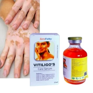 Vitiligo Gel 35ml - beseitigt weiße Flecken, gleicht Ton aus & verblasst Narben - Bild 1 von 6