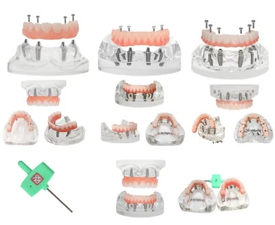 Modelo de implante dental de EE. UU. Modelo de dientes de sobredentadura superior/inferior mandíbula con 4/6 tornillos Foto 1 de 4