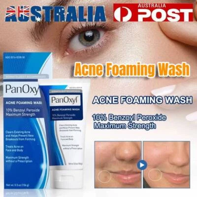 Acne Foaming Wash Face & Body 10% Active ingredient 156g Moisture Sealed Cream - image 1 of 4