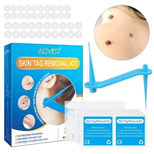 Skin Tag Remover Kit Natural Painless 2 In 1 Bands Warts Mole Removal Treatment - Picture 1 of 6