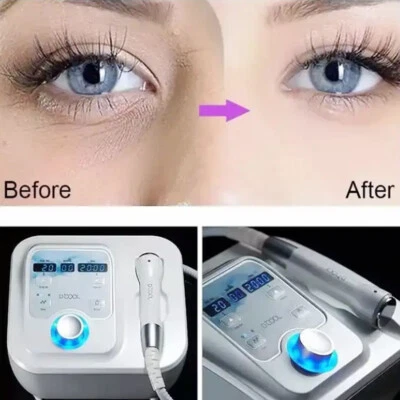 Máquina portátil de mesoterapia de congelación facial criocongelación calefacción refrigeración fría Foto 1 de 4