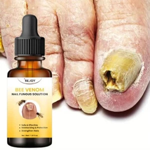 Bee Anti Fungal Nail Treatment Serum Finger Toe Nail Fungus Repair New 1 fl oz - Picture 1 of 8