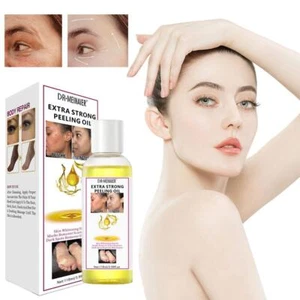 118ml Strong Yellow Peeling Oil Exfoliating Solution Skin~ Dark Body For D8Q4 - Picture 1 of 12