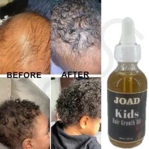kids hair growth oil - Picture 1 of 3