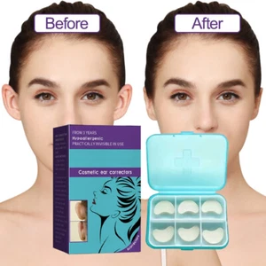 6Pcs Silicone Ear Corrector Cosmetic Instant Ear Correction for Prominent Ears - Picture 1 of 13