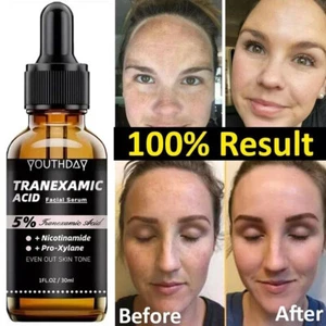 Tranexamic Acid & Niacinamide Correcting Serum for Dark Spots remover Serum 30ml - Picture 1 of 9