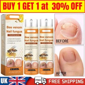 Bee Venom Nail Treatment Spray, Bee Venom Nail Fungus Soothing Spray 20ml - Bild 1 von 19