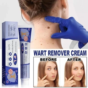 Skin Tag Mole Wart Remover Removal Cream Ointment Fast Safe Natural Treatment - Picture 1 of 10
