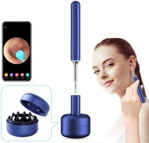 Cámara de eliminación de cera de oído CUREGO HD 1080p 8 MP para iPhone, iPad, teléfonos Android - Imagen 1 de 10