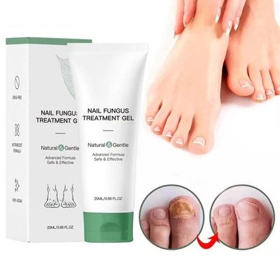 MARKENLOS 20ml Nail Care Gel für Nägel Nagelpilz Hände Fußpflege Behandlung Gel Reparatur
