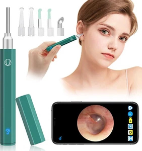 Smart Ear Wax Removal Cleaner Wireless Visual Endoscope Otoscope Camera - Picture 1 of 13