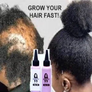 Fenugreek Cloves Herbal Hair Growth Oil - Mega hair Growth 100ml - Picture 1 of 6