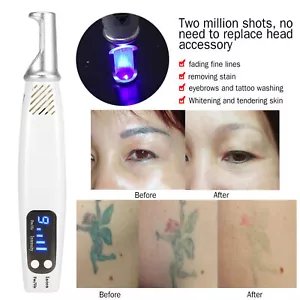 Picosecond Pen Blue Light Electric Laser Therapy Scar Tattoo Removal Beauty Tool - Picture 1 of 11