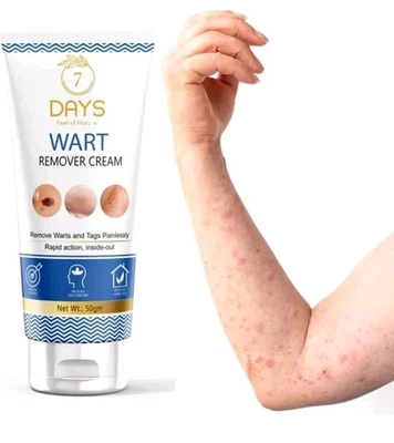 7 Days Natural Wart Remover Cream for Men & Woman 50 Grams - Image 1 of 4