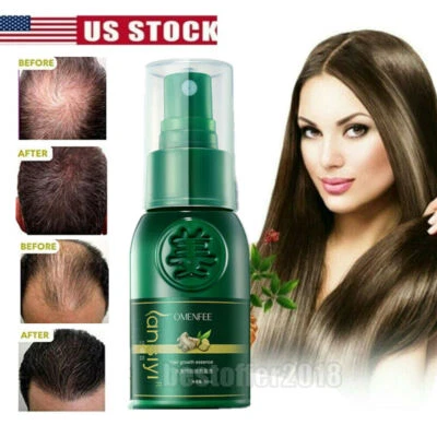 ReGrow Jengibre Germinal Spray Líquido Crecimiento Suero Prevenir Pérdida de Cabello Tratamiento Nuevo Foto 1 de 4