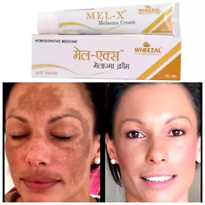 Wheezal Mel-X Melasma Cream for Skin - 25 gm Free Shipping - Picture 1 of 3