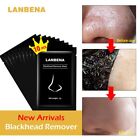 LANBENA, Blackhead Remover, Peel off Deep-Cleansing Facial Strips (10 Strips)