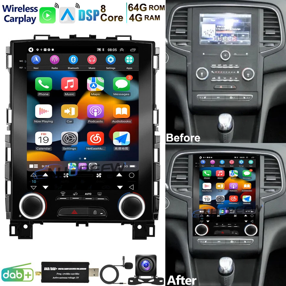 NHOPEEW 8-Kern 4+64GB Android 15 Autoradio Carplay DAB+ Für Renault Megane IV KOLEOS II