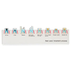 Dental Endodontic Endo Root Canal Treatment Process Flowchart Guide Teach Model - Picture 1 of 17