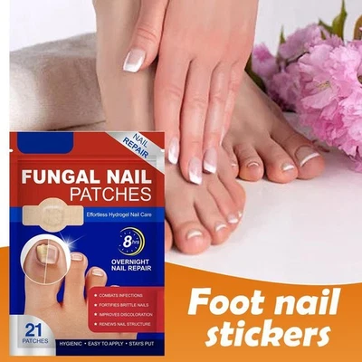 MARKENLOS Pilz Nagel Patches Fuß Nagelpflege Übernachtung Nagel DE Reparatur G6T8