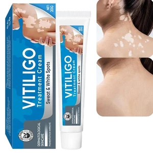 Vitiligo Cream, Vitiligo Treatment Cream, Vitiligo Cream for Skin Healthy Care - Picture 1 of 7