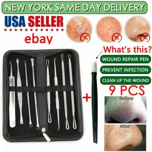 9 Pcs Professional Comedone Extractor Acne Removal Kit For Whitehead Popping Zit - Picture 1 of 9
