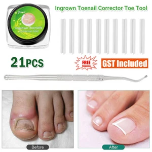 21Pc Ingrown Toenail Corrector Toe Foot Nail Correction Sticker Pedicure Tool AU - Picture 1 of 17