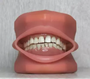 Kilgore Nissin Parodontal Zahn Zähne Modell TR 56C Typodont Modell LESEN - Bild 1 von 23
