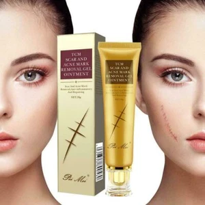 30g Scar Acne Stretch Mark Removal Ointment Gel Cream Cuts Burns Wounds. - Bild 1 von 9