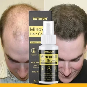 Minoxidil 5% Hair Growth Spray Serum Men Hair Loss Treatment 1 Month Supply 60ML - Picture 1 of 22