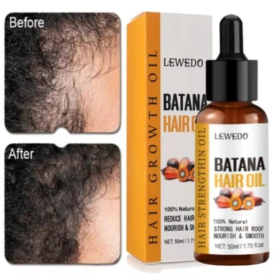 Batana Oil Serum Hair Regrowth Thickening Mens & Womens Hair Growth Hair Care - image 1 of 4