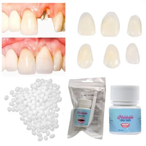 Temporary Tooth Repair Kit Resin Fix Broken False Teeth Fill Gap Dental Denture, - Picture 1 of 11