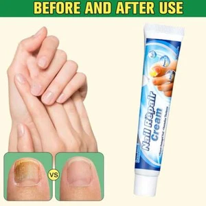 1x Crema Antifúngica Crema Reparadora de Uñas Cuidado Uñas Ungüento Suave para Uñas [20g] - Imagen 1 de 10