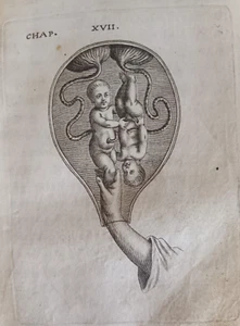 Beobachtungen zur Praxis der Naturgeburten Viardel Geburtshilfe 1673 - Bild 1 von 12
