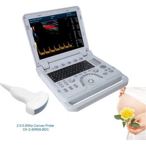 Tragbarer Ultraschallgerät Farbdoppler Digitaler Ultraschallscanner Konvex sonde - Picture 1 of 14
